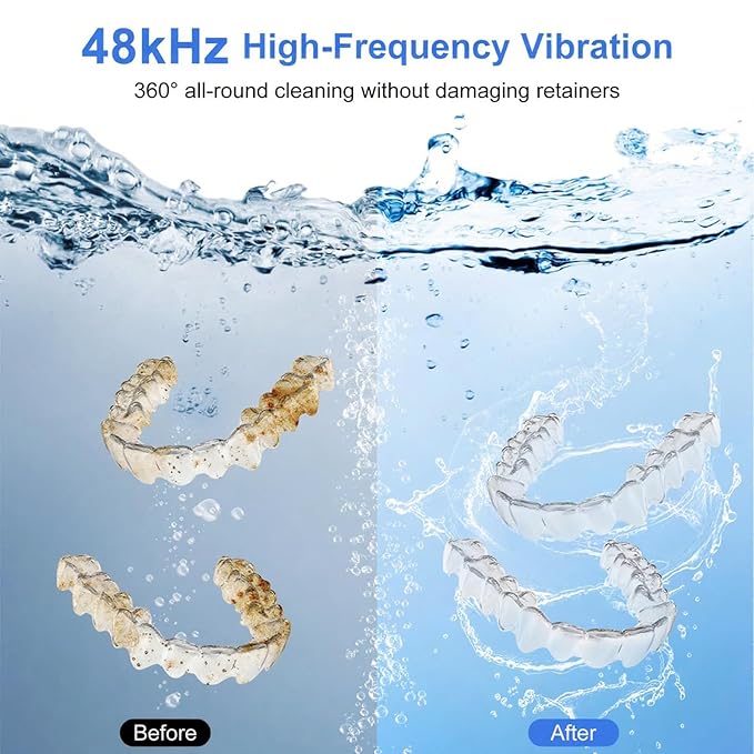 Ultrasonic Retainer Cleaner Machine 48kHz Denture Cleaner 200ml Dental Appliance Cleaner for Aligner, Night Guard, Brace, Jewelry
