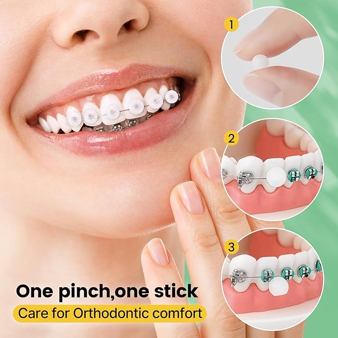 Orthodontic Wax for Braces Wax Individual Hygienic Packaging Dental Wax Dots (90PCS, Strawberry)