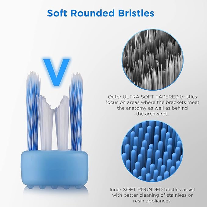 V-Shaped Orthodontic Toothbrush for Braces, Soft Bristles, 6 Count