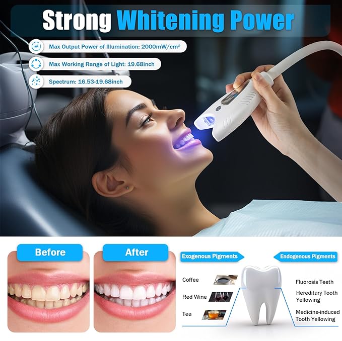 Portable Teeth Whitening Machine with LED Light, Teeth Bleaching Accelerator Light, LED Dental Teeth Whitening Light with Bleaching Accelerator