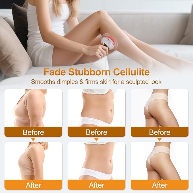 Lymphatic Drainage Massager, Anti-Cellulite & Stretch Mark Reduction Body Sculpting Machine for Legs, Arms & Belly, Skin Firming & Fat Loss, with Microcurrent, Heat, Light & Vibration