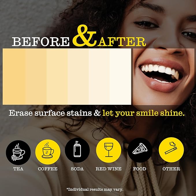 Twice Twice Teeth Whitening Strips – 20-Day Treatment, Coconut Oil Enhanced, No-Slip, Vegan, Easy to Use, Sweet Mint Flavor, Gentle Whitening Designed with Care for a Brighter Smile