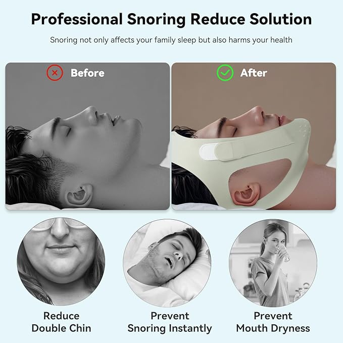 Anti Snore Chin Strap, Snore Stopper with Adjustable Velcro Chin Strap for Sleeping Comfortable Stop Snoring Solution Anti Snoring Devices Breathable and Reusable （Two Couple Outfits） (L)