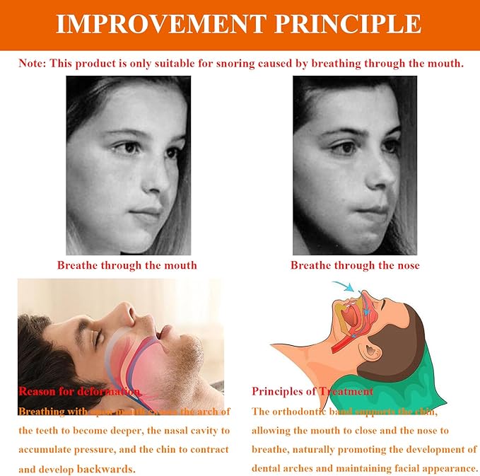 Anti Snore Chin Strap, Chin Strap for Snoring, Chin Strap for Sleeping, Anti Snore Chin Strap to Keep Mouth Closed While Sleeping, Adjustable & Breathable Chin Strap for CPAP User (Black)