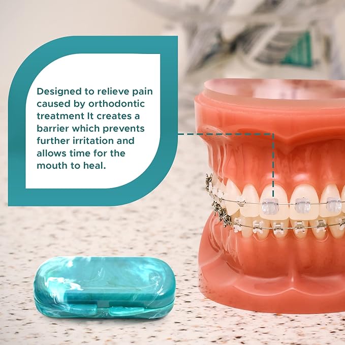 Orthodontic Dental Wax for Braces – Premium Braces Wax in Designer Marble Cases, Tooth Wax for Braces, Clear & Unscented, 10-Pack Assorted Colors