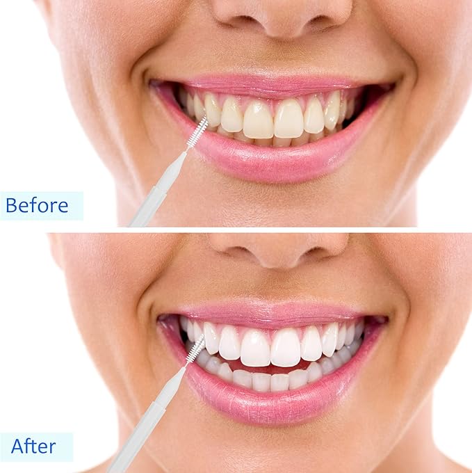 Patelai 50 Pieces Interdental Brush for Cleaner Braces Brush Toothpick Dental Tooth Flossing Head Oral Dental Hygiene Flosser Toothpick Cleaners Tooth Cleaning Tool(Black, White)