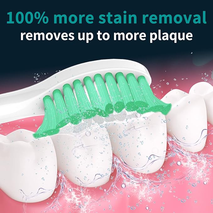 Aoremon Replacement Heads Compatible with Sonicare E-Series, Toothbrush Heads Come with Caps Fit for Sonicare Essence Xtreme Elite Advance and CleanCare Screw-on Toothbrush Handles, 5 Pack