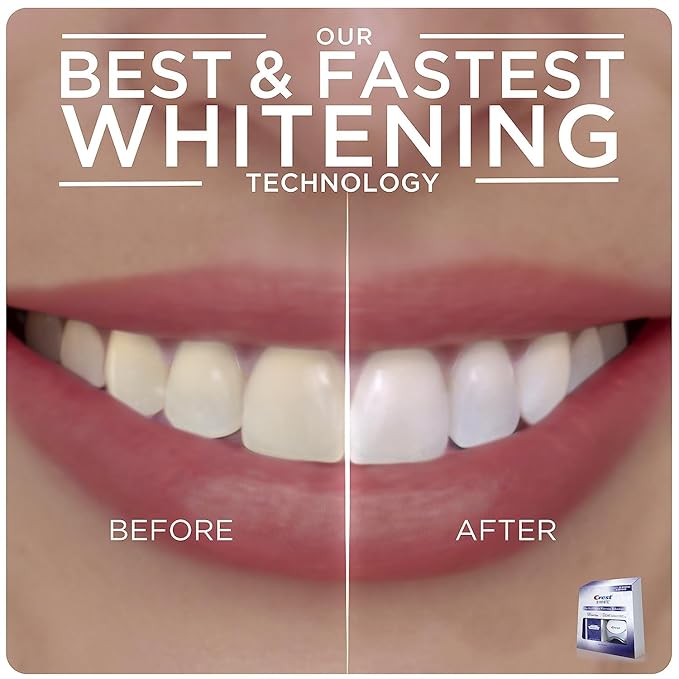 Crest 3D Whitestrips + LED Light – Teeth Whitening Kit, 1 Light + 10 Treatments, Each with 1 Upper/1Lower, 20 Strips – Crest 3DWhite Teeth Whitening Strips