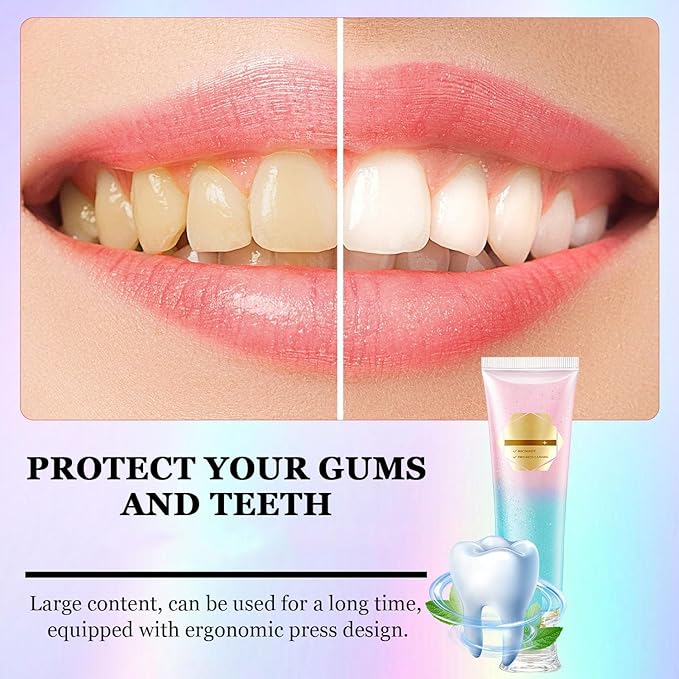 Acssart Radiant Whitening Toothpaste, Nicotinamide Dazzle Toothpaste, Intensive White Toothpastes, Nicotinamide White Toothpastes, Deep Cleaning 2pcs