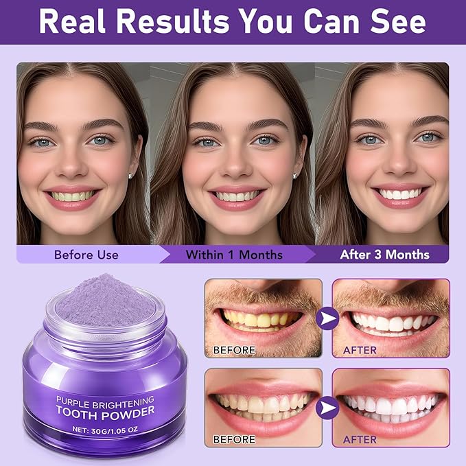 Teeth Whitening Powder,Purple Gentle Tooth Whitener,Safe & Gentle Formula,No Sensitivity,Daily Use, Enamel Friendly,Stain Removal, Color Corrector, and Toothpaste Booster (1)