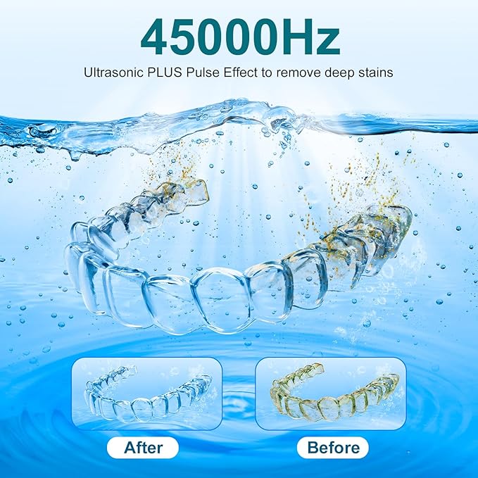 Ultrasonic Retainer Cleaner, 45kHz Retainer Cleaner Machine for Denture Cleaning Pod for Mouth Guards|Aligners|Braces|Toothbrush Heads|Jewelry, 200ML Dental Cleaning Pod with 4 Modes & Digital Timer