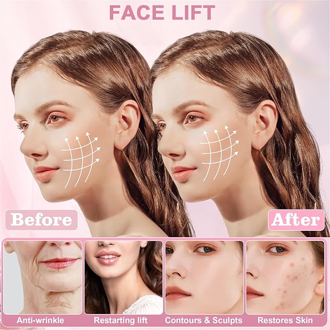 Chin Strap for Sleeping,Anti Snoring Chin Strap for CPAP Users,V-Line Lifting Mask,Adjustable and Breathable Chin Strap-Keep Mouth Closed for Effectively Reduce Snoring (Pink-White)