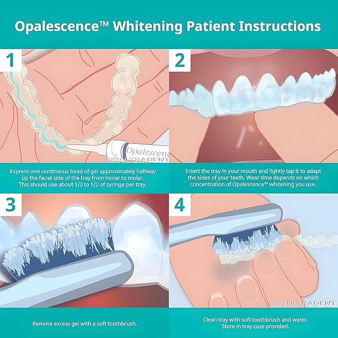 Opalescence 20% Teeth Whitening Refill Kit (4 Syringes) Carbamide Peroxide. Made by Ultradent, in Mint Flavor. Tooth Whitening Refill Syringes - B-5196-4