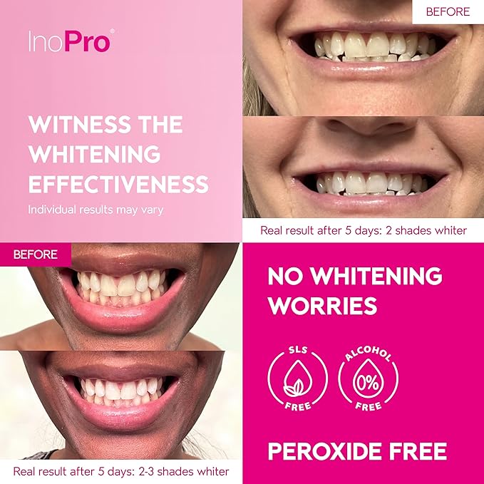 InoPro Teeth Whitening Strips 14 Treatments Kit - Teeth Whitener, Peroxide Free, Green White Strips for Teeth Whitening with Arbutin, Coconut Oil, Deep Stains Removal (28 Strips)