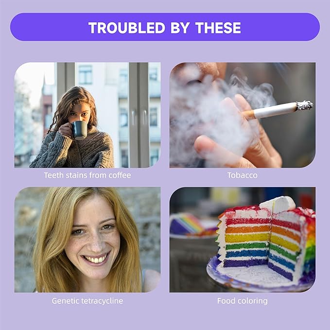 Teeth Whitening Gel Pens V34 Purple Teeth Whitener Non Sensitive 25% Carbamide Peroxide Teeth Color Corrector Whitening, (3X) 4ml / Pen