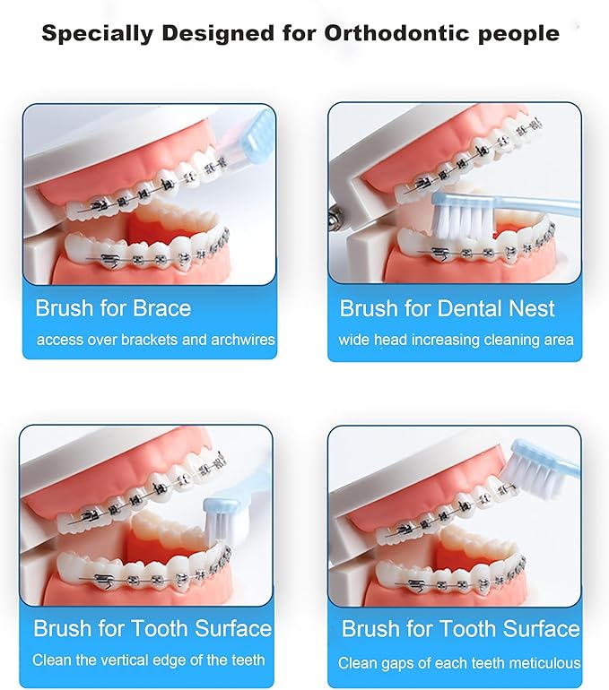 V-Shaped Orthodontic Toothbrush Dental Brush for Braces, for Kids/Teens/Adult, for Sensitive Teeth, for Delicate Gums, Soft Bristles, Toothbrush for Braces, with Tongue Cleaner, Pink, 3pcs