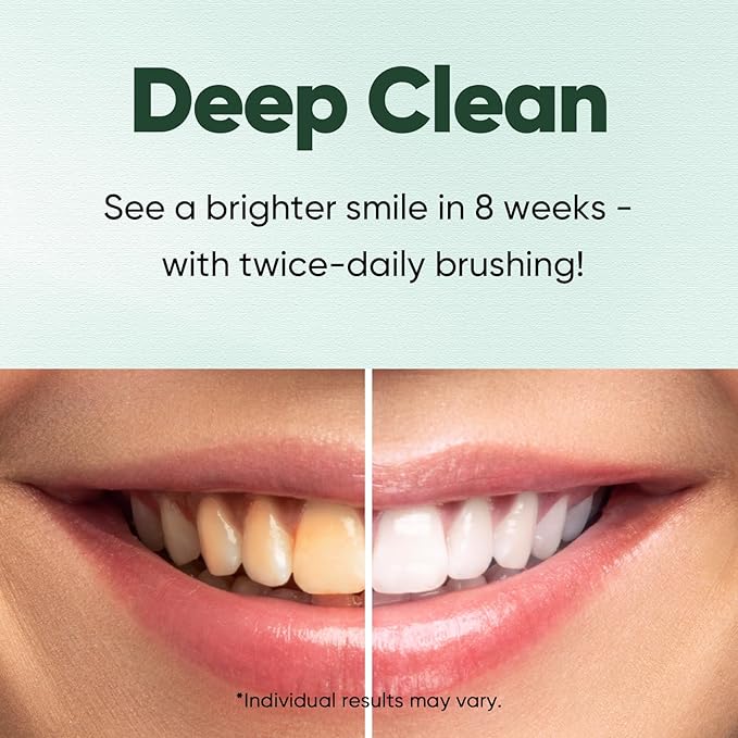 MySmile Fluoride Free Nano Hydroxyapatite Toothpaste for Sensitive Teeth, Strengthens Enamel, Remineralizes & Whitens Teeth, Freshens Breath for Adults, SLS Free, Natural Misty Mint, 4.2 oz, 2 Pack