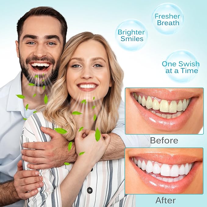 Coconut Pulling Oil, Oil Pulling Travel Sachets 20Pcs, Mint Oil Pulling Mouthwash for Teeth Travel Sizes, Natural Coconut Oil Pulling with Coconut & Peppermint Oil-Mouthwash