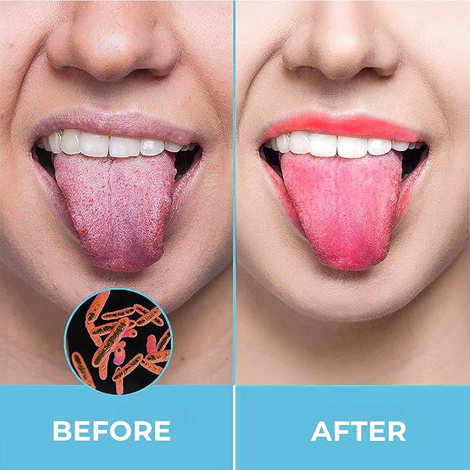 HOKIN Tongue Scraper for Adults with Travel Case (1Pcs Oral Care Pack) - 100% Metal Spoon Shaped Tongue Cleaner, Tough Scraper for Oral Hygiene