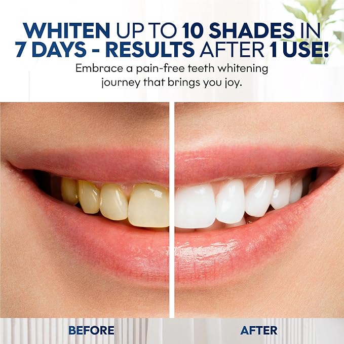 Chloe’C Teeth Whitening Strips | 7 Mint-Flavored Treatments for Sensitive Teeth | Non-Toxic Whitening Strips | Enamel Safe & Peroxide-Free | Removes Stains in 7 Days | Gentle-Effective Teeth Whitening