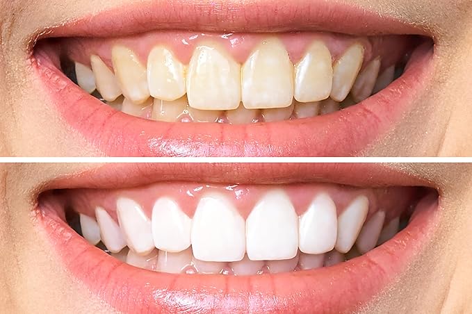 Dr. George's Dental White Whitening for Two by Dr. George's