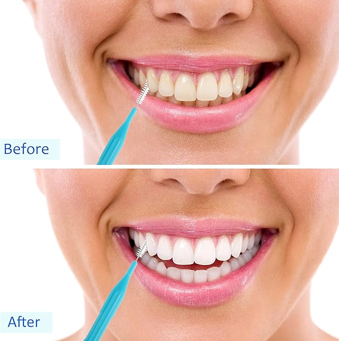 100 Pieces Braces Brush for Cleaner Interdental Brush Toothpick Dental Flossing Head Oral Hygiene Flosser Tooth Cleaning Tool (Light Blue, Pink, Yellow, Light Green)